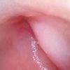 SOAIM SA Series — sample endoscopic mucosal image demonstrating high-definition clarity in gastrointestinal examination