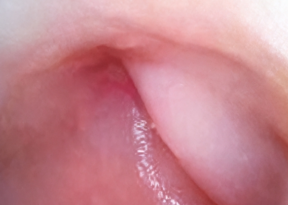 SOAIM SA Series — sample endoscopic mucosal image demonstrating high-definition clarity in gastrointestinal examination