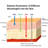 IWA-RLT20 — relative penetration of blue, green, red, and near-infrared wavelengths through skin layers