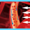 IWA-RLT40 — illustration of improved local circulation after red light therapy